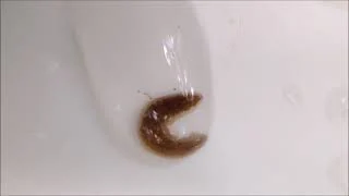 Identify this Creek Critter | Planaria in a water droplet